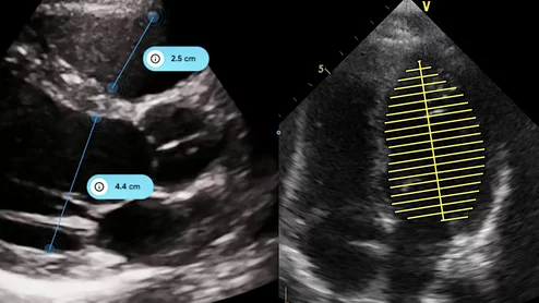 The iCardio.ai EchoMeasure AI software to automate measurements for cardiac echo imaging. It was FDA cleared in October 2024.