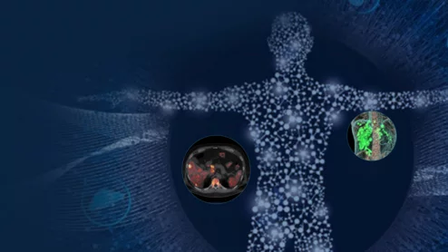 Theranostics GE HealthCAre