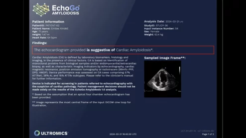 Ultromics EchoGo Amyloidosis artificial intelligence