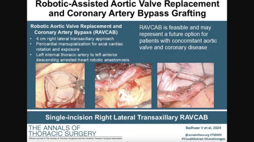 Back in October 2024, heart surgeons with the WVU Heart and Vascular Institute in Morgantown, West Virginia, performed the world’s first robotic aortic valve replacement and coronary artery bypass (RAVCAB) procedure. Now, the team behind that historic surgery has shared its full story for the first time, publishing an in-depth look at the procedure in The Annals of Thoracic Surgery, an official journal from the Society of Thoracic Surgeons.[1]
