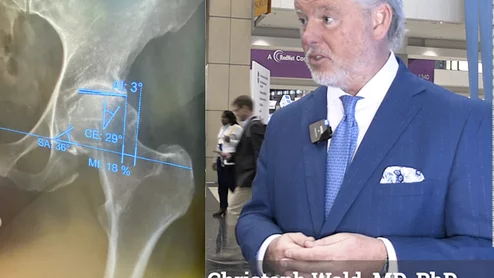 Video Christoph Wald explains how the Health AI Challenge help understand how foundational AI models work