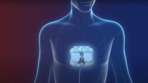 Realheart Total Artificial Heart