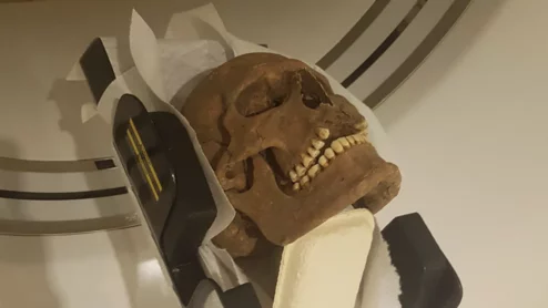 Researchers use CT scans to study Viking skulls.