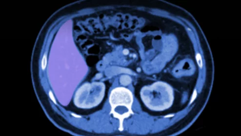 PocketHealth's Image Readers helps patients understand their radiology report findings.