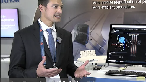 Evan Scott Shlofmitz, DO, Director of Intravascular Imaging, St. Francis Hospital, in Roslyn, New York, explains how he uses Heartflow's artificial intelligence technology to assess a patient's coronary artery disease from noninvasive CT scans to preplan PCI procedures. 