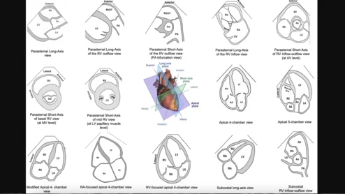 Standard transthoracic imaging planes for comprehensive right heart assessment. Several key views should be included in the standard echocardiographic assessment of the right heart. Image and caption courtesy of the American Society of Echocardiography.