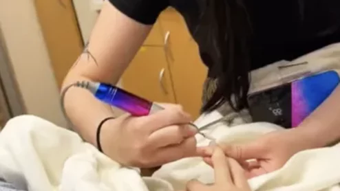 Cat eye manicure an MRI safety risk