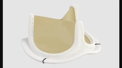 Inspiris Resilia aortic valve from Edwards Lifesciences 