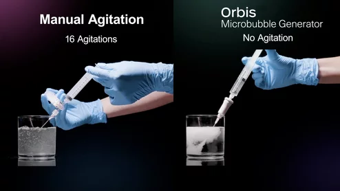 The Agitation Solutions Orbis Microbubble Generator simplifies and streamlines the process of saline agitation and delivery for cardiac bubble studies using a single use syringe. It is was cleared for use in Canada in 2024.