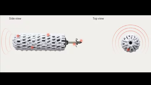 WiSE CRT system EBR Systems leadless pacing