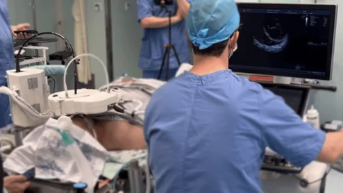 ROB’E Robotic transesophageal echocardiography (TEE)