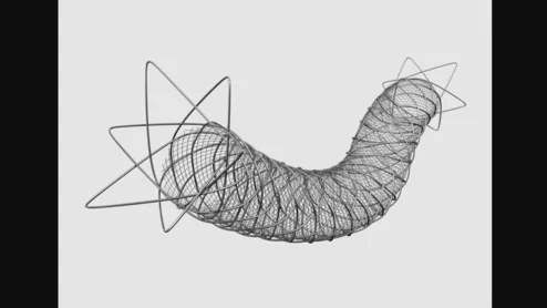 Roadsaver Carotid Stent System