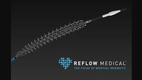 Reflow Medical Spur Peripheral Retrievable Stent System