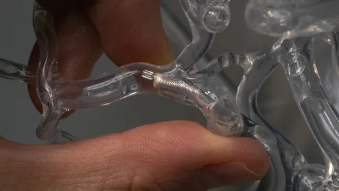 milli-spinner thrombectomy designed to target blood clots by engineers with Stanford University 
