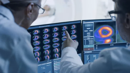 Imagers reviewing flurpiridaz F-18 (Flyrcado) myocardial perfusion PET images. Image from GE Healthcare