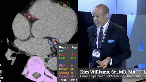 Former American College of Cardiology (ACC) president Kim Allan Williams, Sr., MD, MACC, MASNC, FAHA, FESC, chair, department of medicine, University of Louisville School of Medicine, and an ACC delegate to the American Medical Association House of Delegates, discusses AMA Resolution 404 aimed at improving public awareness of low-dose CT lung cancer screening that can also identify coronary artery disease (CAD) ate the same time. 