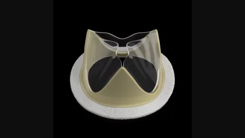 Foldax Tria mitral valve
