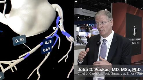 Cardiac surgeon John Puskas, MD, Emory University, says CCTA will make invasive angiography obsolete very soon.