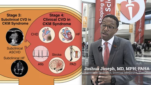 Joshua Joseph, MD, MPH, FAHA an expert in Cardiovascular-Kidney-Metabolic (CKM) syndrome, associate professor of internal medicine, and the Endowed Professor for Research in Internal Medicine in the Division of Endocrinology, Diabetes and Metabolism at The Ohio State University Wexner Medical Center, explains the CKM advisory from the American Heart Association designed to help define and stage the disease. CKM has seen a large amount of growing interest from cardiologists in recent years.