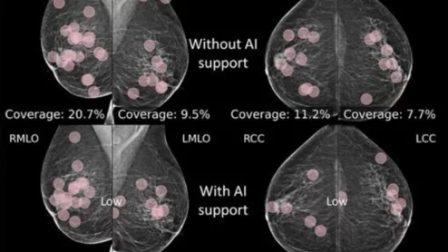 Eye-tracking reveals radiologists' reading habits when under the influence of AI