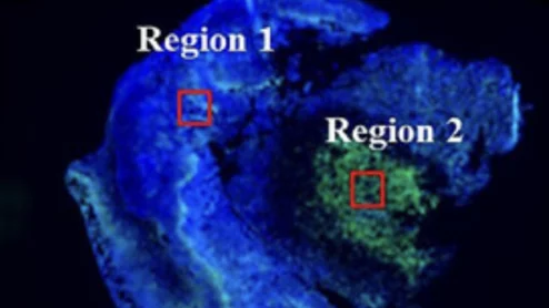 Bacteria-based contrast agent lights up tumor margins significantly better than other agents.