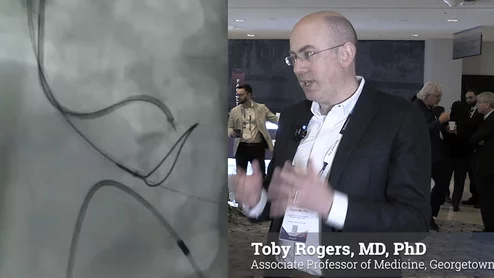Toby Rogers, MD, Medstar, discusses a new dedicated device for BASILICA used in TAVR.