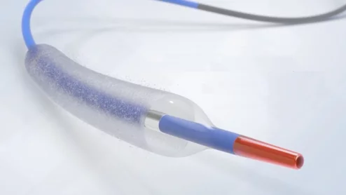 Boston Scientific said it initiated the AGENT DCB STANCE trial to assess the safety and effectiveness of the Agent Drug-Coated Balloon (DCB) compared to the standard of care using either percutaneous coronary intervention (PCI) with drug-eluting stents (DES) and/or balloon angioplasty. The trial will enroll more than 1,600 patients and is expected to a primary completion date in 2028. 