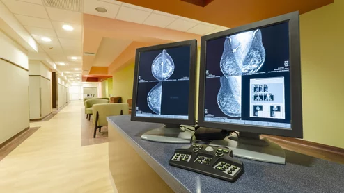 mammography breast imaging