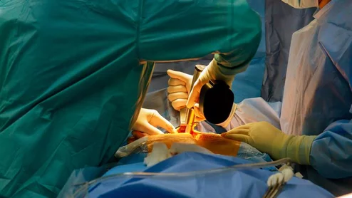 Surgery stock photo