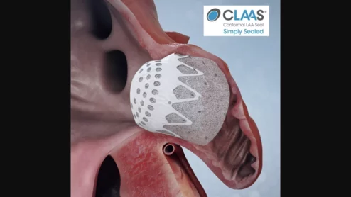 Conformal Medical CLAAS