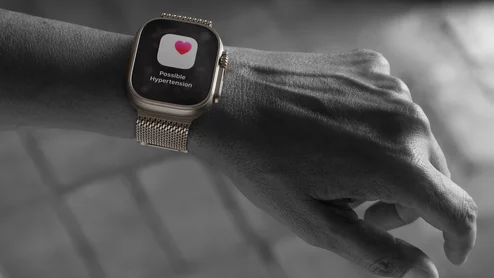 The U.S. Food and Drug Administration (FDA) cleared a smart watch artificial intelligence (AI) algorithm that tells wearers if they are suspected of having hypertension, which is expected to help notify about 1 million users over the next year. This a is a new feature of the newly launched Apple Watch Ultra 3, which the company unveiled Sept. 9. Apple gained FDA for its Cardiovascular Machine Learning-Based Notification Software Hypertension Notification Feature (HTNF) Sept. 11, 2025.