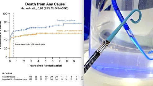 The key figure from NEJM publication confirms the survival benefit of Impella CP increases year-over-year. Source: Møller J, et al. Long Term Outcomes of the DanGer Shock Trial. N Engl J Med 2025.