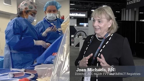 Joan Michaels, RN, director of the American College of Cardiology (ACC) National Cardiovascular Data Registry (NCDR) Transcatheter Valve Therapies (TVT) and IMPACT congenital heart registries, said the addition of the ambulatory surgical center (ASC) registry comes at a time when hospitals are expanding structural heart programs and ASC's will likely play a growing role to help free up more hospital cath labs for the more complex cases. 