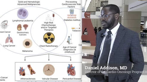 As cancer therapies become increasingly targeted and complex, the need for sophisticated cardiovascular monitoring has grown in parallel. Cardiovascular Business spoke with Daniel Addison, MD, director of the cardio-oncology program at The Ohio State University and chair of the American Heart Association’s (AHA) Cardiac Imaging Committee, who said the use of multimodality imaging is transforming how clinicians manage cardiovascular risk in cancer patients and survivors.