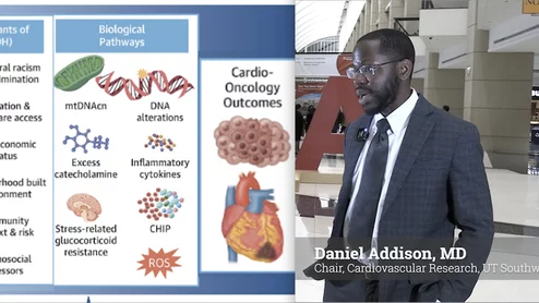 Daniel Addison, MD, Director of Translational Research in the Cardiology Division and Associate Director for Survivorship and Outcomes Research in the Harold C. Simmons Comprehensive Cancer Center. He also holds the Audre and Bernard Rapport Endowed Chair in Cardiovascular Research, UT Southwestern Medical Center. explains the health disparities and inequities involved in cardio-oncology.