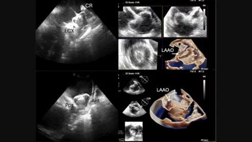 SCAI ICE position statement
