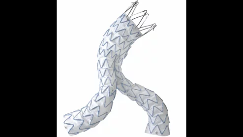 Endurant stent graft system labeling