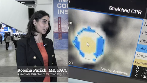 The Society of Cardiovascular Computed Tomography (SCCT) is seeing major progress in its long-running push to secure broad reimbursement for artificial intelligence (AI)-enabled coronary CT angiography (CCTA) plaque analysis. According to Roosha Parikh, MD, FACC, FSCCT, associate director of Cardiac CT at St. Francis Heart Hospital, Long Island, New York, and a member of the SCCT Health Policy and Practice Committee, both Medicare and a growing number of private insurers are now covering the technology.