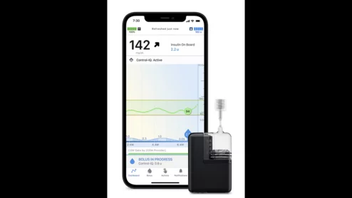 Tandem Mobi Insulin Pump 