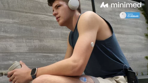 MiniMed 780G system integrated with Instinct sensors manufactured by Abbott.