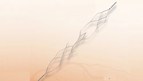 Vesalio enVast coronary mechanical thrombectomy system gained FDA in December 2025.