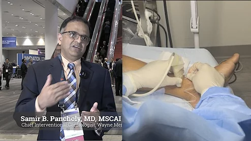 Samir B. Pancholy, MD, chief interventional cardiologist, Wayne Memorial Hospital in Honesdale, Pennsylvania, discusses the differences in the business models for office based labs (OBL) vs ambulatory surgical centers (ASC) and choosing the right model cardiovascular and vascular procedures. #TCT #SCAI #OBL #ASC