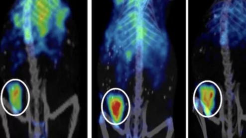 Novel theranostic shows promise for treating gastric and pancreatic cancer