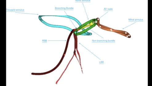 simulation of the conduction pathway relative to various cardiac structures.