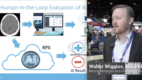 Walter Wiggins, MD, PhD, a neuroradiologist and director of clinical AI at Mosaic, explains how large language model (LLM) artificial intelligence is increasingly being used in radiology to extract structured data from narrative radiology reports to improve workflow, and to help validate, monitor and improve other AI tools being used in clinical practice.