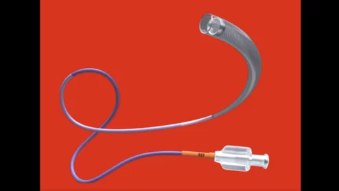 Cereglide 57 image courtesy of Johnson & Johnson MedTech.