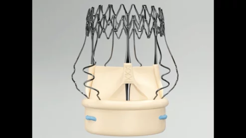 corcym Perceval Plus LANCELOT