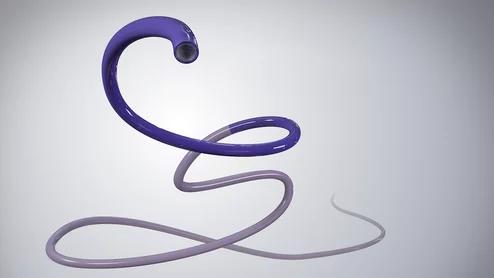 Toro Neurovascular Toro 88 Superbore Catheter 