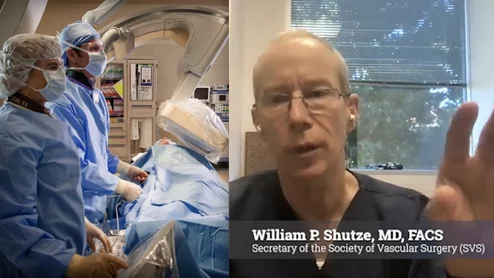 William P. Shutze, MD, FACS, secretary of the Society of Vascular Surgery (SVS), a vascular surgeon with Texas Vascular Associates in Plano, Texas, and a clinical associate professor of medicine at Texas A&M College of Medicine, explained the role of vascular surgeons in peripheral artery disease (PAD) and critical limb ischemia (CLI). 
