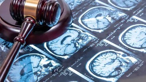 court brain scan legal gavel lawsuit malpractice judge